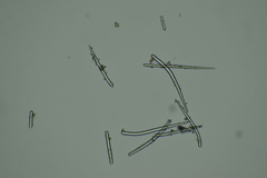 Endectyon hispitumulus