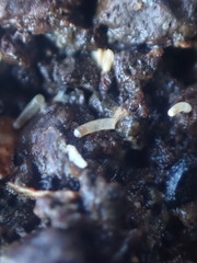 Caecum