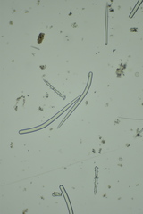 Endectyon hispitumulus