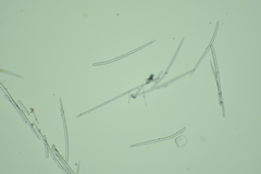 Endectyon hispitumulus