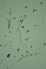 Endectyon hispitumulus