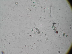 Didymium melanospermum