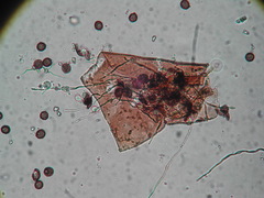 Didymium melanospermum