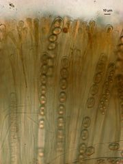 Adelphella babingtonii