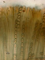 Adelphella babingtonii
