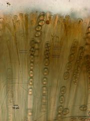 Adelphella babingtonii