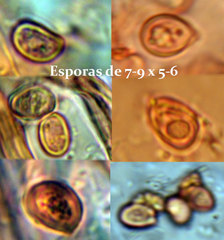 Chaetocalathus craterellus