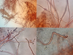 Chaetocalathus craterellus