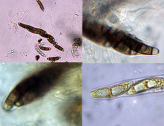 Chaetosphaerella phaeostroma