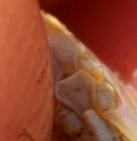 Oecanthus dulcisonans