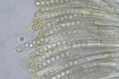 Plicaria endocarpoides