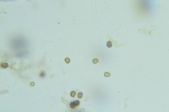 Thelephora cuticularis