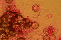 Mycogone calospora