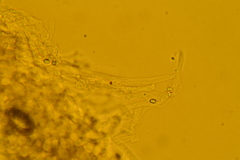 Rimbachia neckerae