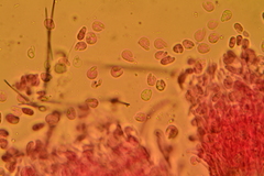 Hyalotrochophora lignatilis