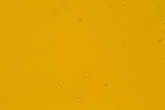Hyalotrochophora lignatilis