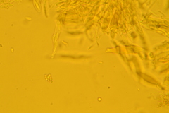 Hyalotrochophora lignatilis