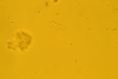 Hyalotrochophora lignatilis