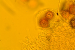 Tuber longisporum