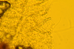 Trechispora regularis