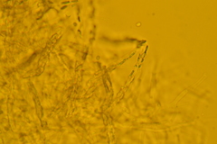 Trechispora regularis