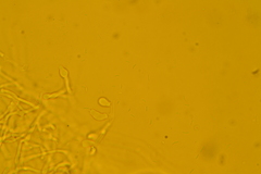 Trechispora regularis