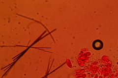 Henningsomyces puber