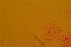 Henningsomyces puber