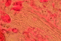 Henningsomyces puber