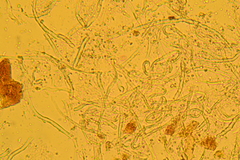 Flagelloscypha minutissima
