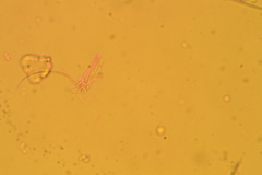 Phanerochaete carnosa