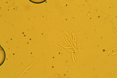 Phanerochaete carnosa