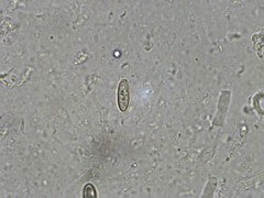 Butyriboletus taughannockensis