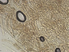 Butyriboletus taughannockensis