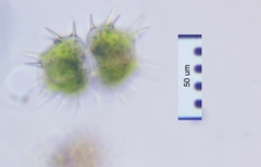 Xanthidium cristatum