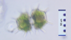 Xanthidium cristatum