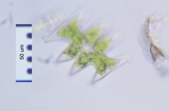 Micrasterias pinnatifida