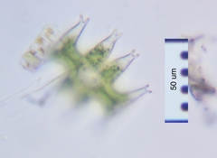 Micrasterias pinnatifida