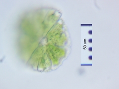Micrasterias conferta