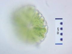 Micrasterias conferta