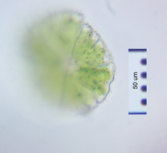 Micrasterias conferta