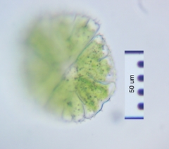 Micrasterias conferta