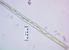 Haplotaenium minutum