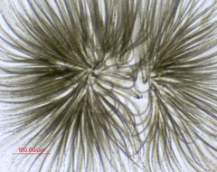 Gloeotrichia echinulata