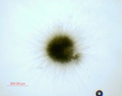 Gloeotrichia echinulata