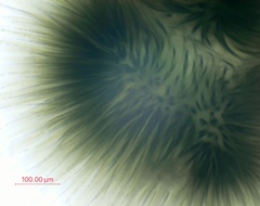 Gloeotrichia echinulata