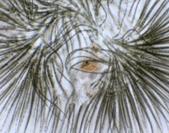 Gloeotrichia echinulata