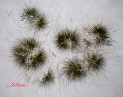 Gloeotrichia echinulata