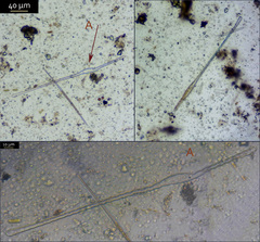 Toxarium undulatum