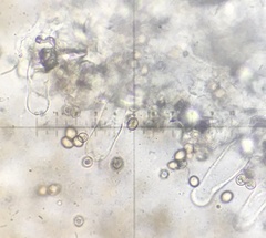 Pluteus septocystidiatus